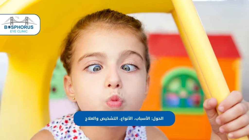 علاج الحول في تركيا