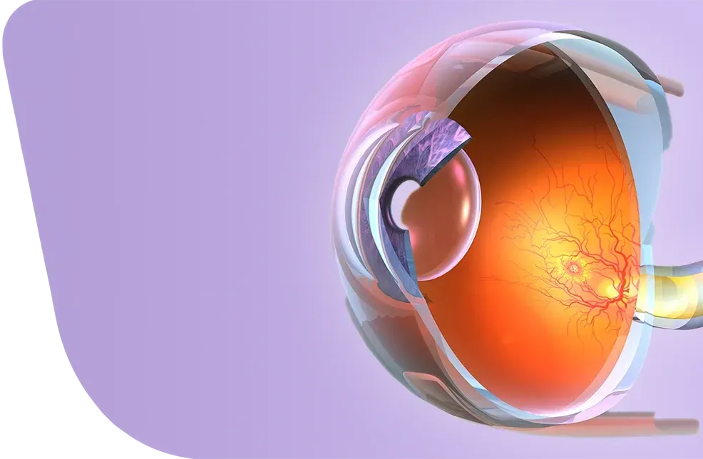 زراعة العدسات الذكية ثلاثية البؤرة في تركيا