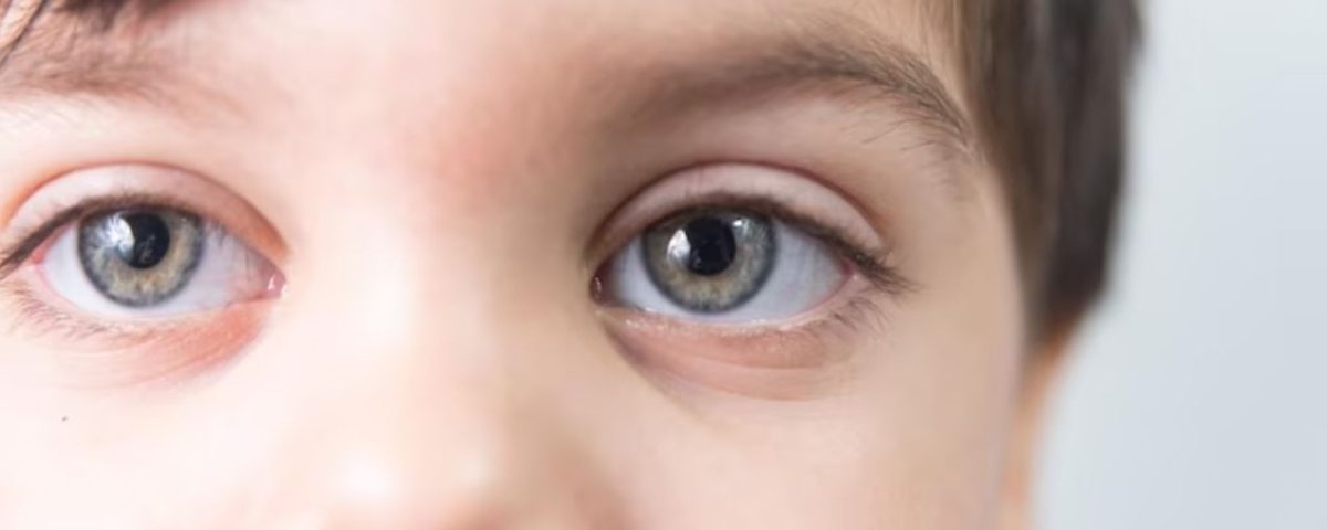 علاج المياه الزرقاء في تركيا