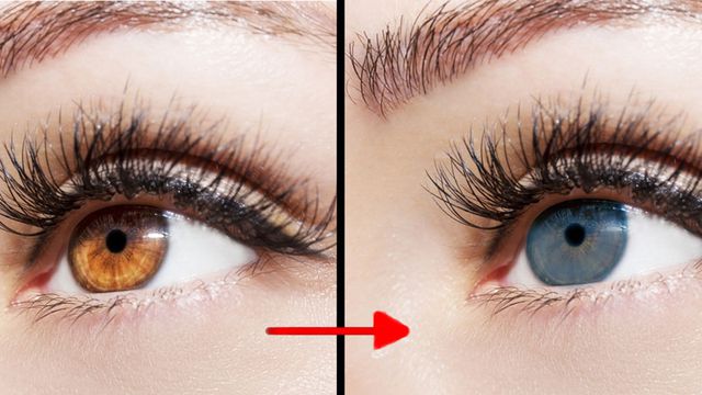 عملية تغيير لون العين في تركيا