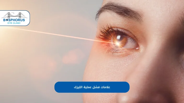 نسبة نجاح عمليات العيون في تركيا 2026